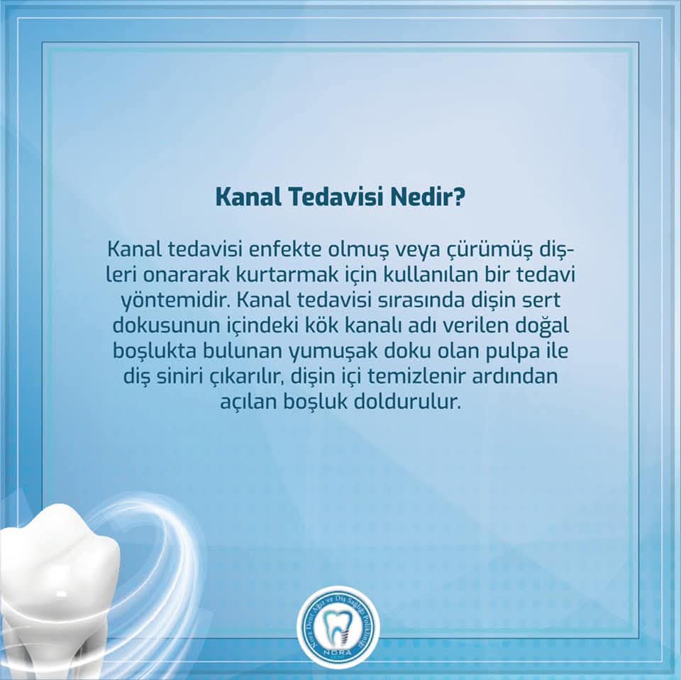 Kanal Tedavisi